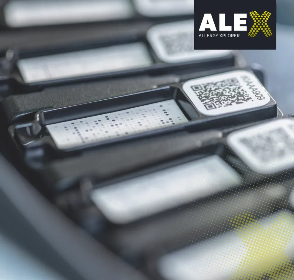 Pruebas de alergia ALEX Allergy Xplorer